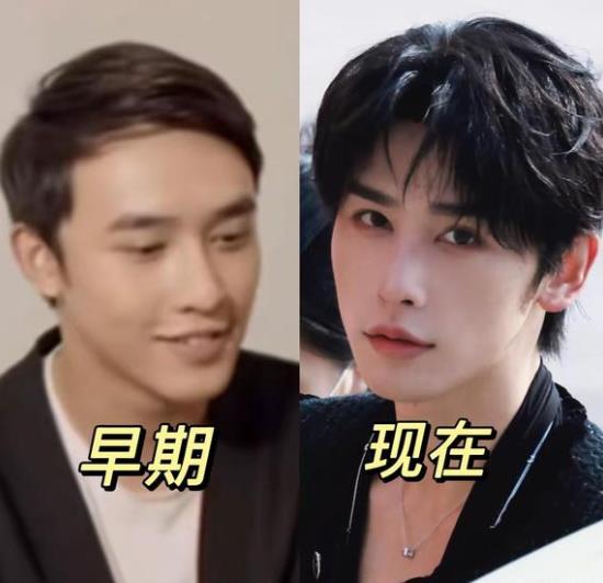 申浩男个人资料简介身高年龄多少 原来的长相被扒整容前后差距太大